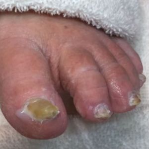 metropolitan nail salon huntsville al diabetic pedicures