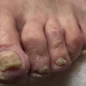 metropolitan nail salon huntsville al geriatric pedicure
